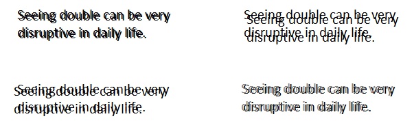 top-causes-of-double-vision